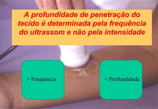 A profundidade de penetração do
tecido é determinada pela frequência
do ultrassom e não pela intensidade
> Frequência < Profundidade
 