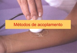 Métodos de acoplamento
 