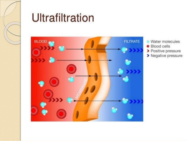 ultrafiltration