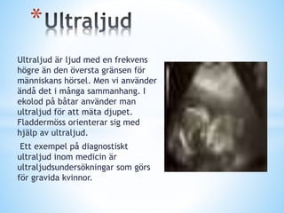 * 
Ultraljud är ljud med en frekvens 
högre än den översta gränsen för 
människans hörsel. Men vi använder 
ändå det i många sammanhang. I 
ekolod på båtar använder man 
ultraljud för att mäta djupet. 
Fladdermöss orienterar sig med 
hjälp av ultraljud. 
Ett exempel på diagnostiskt 
ultraljud inom medicin är 
ultraljudsundersökningar som görs 
för gravida kvinnor. 
 