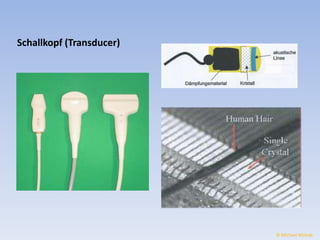 Schallkopf (Transducer) 
© Michael Wolrab 
 