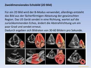 Zweidimensionales Echobild (2D Bild) 
Für ein 2D Bild wird der B-Modus verwendet, allerdings entsteht 
das Bild aus der fächerförmigen Abtastung der gewünschten 
Region. Das US Gerät sendet in eine Richtung, wartet auf die 
zurückkommenden Echos, ändert die Abstrahlrichtung um ein 
paar Grad und sendet erneut. 
Dadurch ergeben sich Bildraten von 30-60 Bildern pro Sekunde. 
© Michael Wolrab 
 