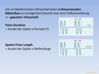 Um im Medizinischen Ultraschall einen 2-dimensionalen 
Bildaufbau zu ermöglichen braucht man eine Tiefenzuordnung 
=> gepulster Ultraschall 
Pulse Duration 
= Anzahl der Zyklen x Periode (T) 
Spatial Pulse Length 
= Anzahl der Zyklen x Wellenlänge 
© Michael Wolrab 
 