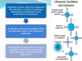12
cavitation occurs when the ultrasonic
file vibrates in a liquid to produce
alternating compressions and
rarefractions of pressure.
A negative pressure develops within
the exposed cells of the intracanal
materials.
This causes an implosion, or inward
explosion, that breaks these cells
apart inwardly and leads to their
destruction.
 