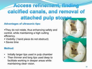 39
Advantages of ultrasonic tips:
They do not rotate, thus enhancing safety and
control, while maintaining a high cutting
efficiency.
 Visibility ( hand piece do not obstruct)
 Saves time
Method:
• Initially larger tips used in pulp chamber
• Then thinner and long tips used deep to
facilitate working in deeper areas while
maintaining clear vision.
 