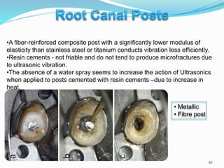 41
• Metallic
• Fibre post
•A fiber-reinforced composite post with a significantly lower modulus of
elasticity than stainless steel or titanium conducts vibration less efficiently.
•Resin cements - not friable and do not tend to produce microfractures due
to ultrasonic vibration.
•The absence of a water spray seems to increase the action of Ultrasonics
when applied to posts cemented with resin cements –due to increase in
heat.
 