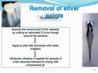 43
TECHNIQUE
Expose the coronal part of the obstacle
by cutting an estimated 2.0-mm trough
around the obstacle
Apply to side with full power with water
irrigation
Ultrasonic vibration is applied for periods of
a few seconds followed by drying with
compressed air
 
