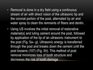• Removal is done in a dry field using a continuous
stream of air with direct vision of the ultrasonic tip and
the coronal portion of the post, alternated by air and
water spray to clean the remnants of fibers and dentin.
• Using US involves the initial removal of restorative
material(s) and luting cement around the post, followed
by application of the tip of an ultrasonic instrument to
the post (Fig. 5a– g). Ultrasonic energy is transferred
through the post and breaks down the cement until the
post loosens (107) (Fig. 5h). This method of post
removal minimizes loss of tooth structure and
decreases the risk of tooth damage
 