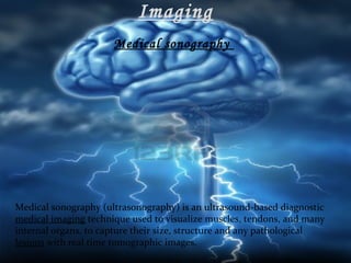 Imaging
Medical sonography

Medical sonography (ultrasonography) is an ultrasound-based diagnostic
medical imaging technique used to visualize muscles, tendons, and many
internal organs, to capture their size, structure and any pathological
lesions with real time tomographic images.

 