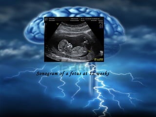 Sonogram of a fetus at 12 weeks

 