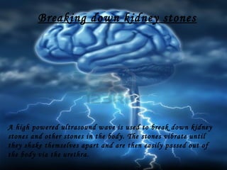 Breaking down kidney stones

A high powered ultrasound wave is used to break down kidney
stones and other stones in the body. The stones vibrate until
they shake themselves apart and are then easily passed out of
the body via the urethra.

 