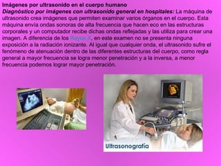 Imágenes por ultrasonido en el cuerpo humano Diagnóstico por imágenes con ultrasonido general en hospitales:  La máquina de ultrasonido crea imágenes que permiten examinar varios órganos en el cuerpo. Esta máquina envía ondas sonoras de alta frecuencia que hacen eco en las estructuras corporales y un computador recibe dichas ondas reflejadas y las utiliza para crear una imagen. A diferencia de los  Rayos X , en este examen no se presenta ninguna exposición a la radiación ionizante. Al igual que cualquier onda, el ultrasonido sufre el fenómeno de atenuación dentro de las diferentes estructuras del cuerpo, como regla general a mayor frecuencia se logra menor penetración y a la inversa, a menor frecuencia podemos lograr mayor penetración. 