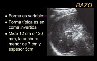 BAZO
 Forma es variable
 Forma típica es en
coma invertida
 Mide 12 cm o 120
mm, la anchura
menor de 7 cm y
espesor 5cm
 