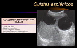 Quistes esplénicos
 
