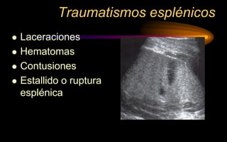 Traumatismos esplénicos
 Laceraciones
 Hematomas
 Contusiones
 Estallido o ruptura
esplénica
 