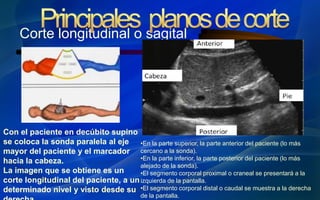 Corte longitudinal o sagital
Con el paciente en decúbito supino
se coloca la sonda paralela al eje
mayor del paciente y el marcador
hacia la cabeza.
La imagen que se obtiene es un
corte longitudinal del paciente, a un
determinado nivel y visto desde su
•En la parte superior, la parte anterior del paciente (lo más
cercano a la sonda).
•En la parte inferior, la parte posterior del paciente (lo más
alejado de la sonda).
•El segmento corporal proximal o craneal se presentará a la
izquierda de la pantalla.
•El segmento corporal distal o caudal se muestra a la derecha
de la pantalla.
 