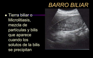 BARRO BILIAR
 Tierra biliar o
Microlitiasis,
mezcla de
partículas y bilis
que aparece
cuando los
solutos de la bilis
se precipitan
 