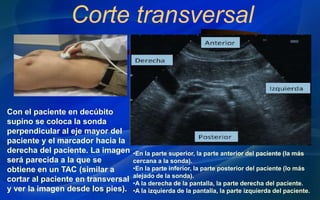 Corte transversal
Con el paciente en decúbito
supino se coloca la sonda
perpendicular al eje mayor del
paciente y el marcador hacia la
derecha del paciente. La imagen
será parecida a la que se
obtiene en un TAC (similar a
cortar al paciente en transversal
y ver la imagen desde los pies).
•En la parte superior, la parte anterior del paciente (la más
cercana a la sonda).
•En la parte inferior, la parte posterior del paciente (lo más
alejado de la sonda).
•A la derecha de la pantalla, la parte derecha del paciente.
•A la izquierda de la pantalla, la parte izquierda del paciente.
 
