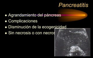 Pancreatitis
 Agrandamiento del páncreas
 Complicaciones
 Disminución de la ecogenicidad
 Sin necrosis o con necrosis
 