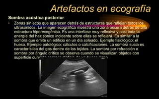 Artefactos en ecografía
Sombra acústica posterior
• Zonas sin ecos que aparecen detrás de estructuras que reflejan todos los
ultrasonidos. La imagen ecográfica muestra una zona oscura detrás de una
estructura hiperecogénica. Es una interfase muy reflexiva y casi toda la
energía del haz sónico incidente sobre ellas se reflejará. Es similar a la
sombra que emite un edificio en un día soleado. Ejemplo fisiológico: el
hueso. Ejemplo patológico: cálculos o calcificaciones. La sombra sucia es
característica del gas dentro de los tejidos. La sombra por refracción o
sombra por ángulo crítico se observa cuando se visualizan objetos con
superficie curvada como la diáfisis de un hueso largo
 