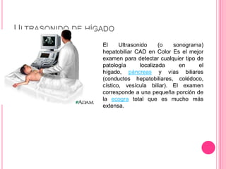 ULTRASONIDO DE HÍGADO
El
Ultrasonido
(o
sonograma)
hepatobiliar CAD en Color Es el mejor
examen para detectar cualquier ti...