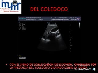 Ultrasonido De Vesicula Y Vias Biliares Romel PDF ultrasonido-de-vesicula-y-vias-biliares-romel-pdf