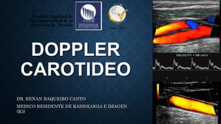 DOPPLER
CAROTIDEO
DR. RENAN BAQUEIRO CANTO
MEDICO RESIDENTE DE RADIOLOGIA E IMAGEN
(R3)
 