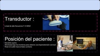 Transductor :
Lineal de alta frecuencia 7-14 MHZ
Posición del paciente :
Decúbito supino
Almohada bajo los hombros para obtener una hiperextensión cervical
Rotar el cuello hacia el lado contrario
 