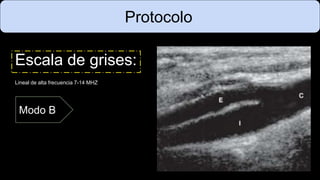 Protocolo
Escala de grises:
Lineal de alta frecuencia 7-14 MHZ
Modo B
 
