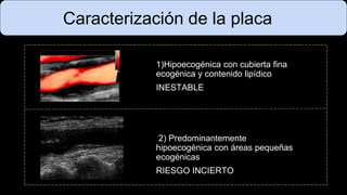 Caracterización de la placa
1)Hipoecogénica con cubierta fina
ecogénica y contenido lipídico
INESTABLE
2) Predominantemente
hipoecogénica con áreas pequeñas
ecogénicas
RIESGO INCIERTO
 