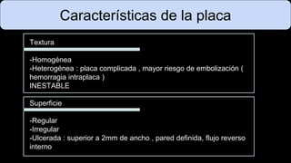 Características de la placa
Textura
-Homogénea
-Heterogénea : placa complicada , mayor riesgo de embolización (
hemorragia intraplaca )
INESTABLE
Superficie
-Regular
-Irregular
-Ulcerada : superior a 2mm de ancho , pared definida, flujo reverso
interno
 
