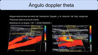 Ángulo doppler theta
-Ángulo entre la línea de visión del transductor Doppler y la dirección del flujo sanguíneo
-Presionar sobre la zona de interés
-Mantener en un ángulo < 60 ° ( 30-60 GRADOS )
 
