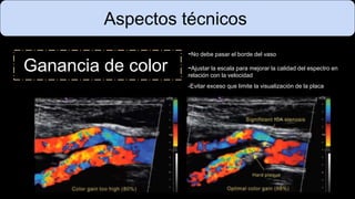 Aspectos técnicos
Ganancia de color
-No debe pasar el borde del vaso
-Ajustar la escala para mejorar la calidad del espectro en
relación con la velocidad
-Evitar exceso que limite la visualización de la placa
 