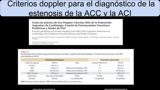Criterios doppler para el diagnóstico de la
estenosis de la ACC y la ACI
 