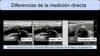 Diferencias de la medición directa
 