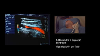 5.Recuadro a explorar
centrado
visualización del flujo
 