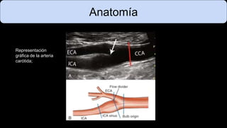 Anatomía
Representación
gráfica de la arteria
carótida;
 