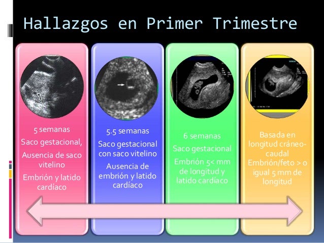 Ultrasonido En El Embarazo