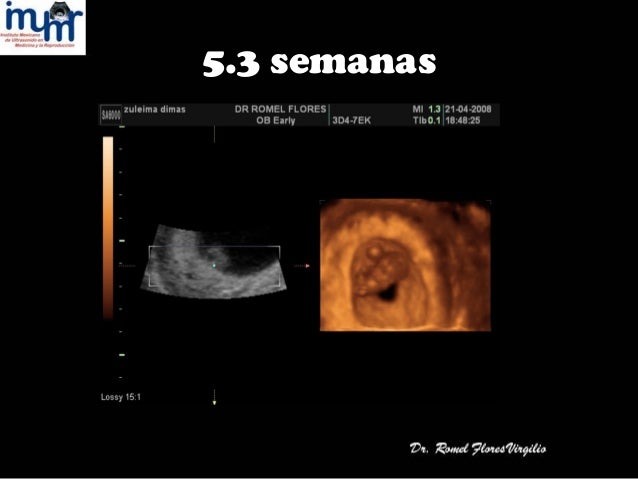 Ultrasonido En El Crecimiento Fetal Normal Y Anormal Dr Romel