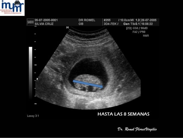 Como Se Ve Un Bebe De 7 Semanas De Gestacion En Un Ultrasonido Consejos De Bebe Como Se Ve Un Bebe De 7 Semanas De Gestacion En Un Ultrasonido Consejos De Bebe