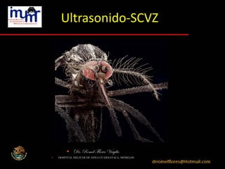 Ultrasonido-SCVZ
 Dr. Romel Flores Virgilio
 HOSPITAL MILITAR DE ZONA CUARNAVACA, MORELOS
 