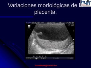 Ultrasonido en la evaluacion placentaria. dr romel imumr