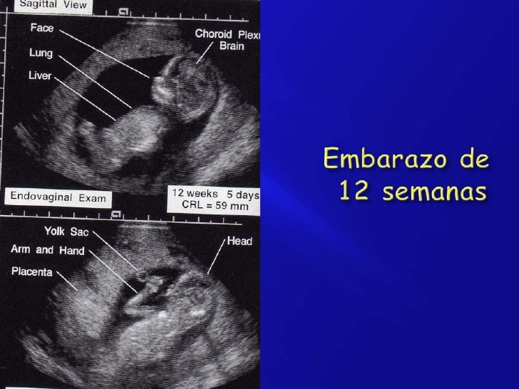 ultrasonidos pelvicos
