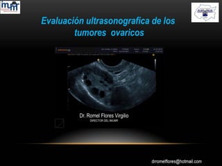 Evaluación ultrasonografica de los
tumores ovaricos
Dr. Romel Flores Virgilio
DIRECTOR DEL IMUMR
 