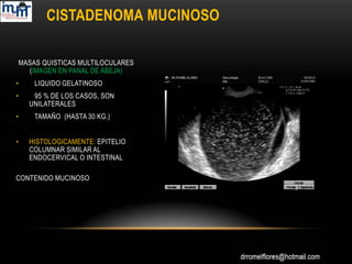 Ultrasonido en los tumores de ovario (dr. romel flores   imumr.)