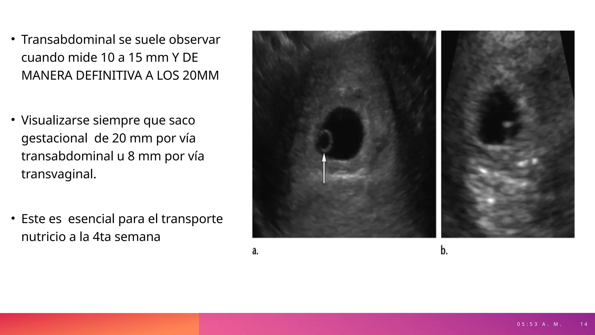 0 5 : 5 3 A . M . 1 4
• Transabdominal se suele observar
cuando mide 10 a 15 mm Y DE
MANERA DEFINITIVA A LOS 20MM
• Visualizarse siempre que saco
gestacional de 20 mm por vía
transabdominal u 8 mm por vía
transvaginal.
• Este es esencial para el transporte
nutricio a la 4ta semana
 