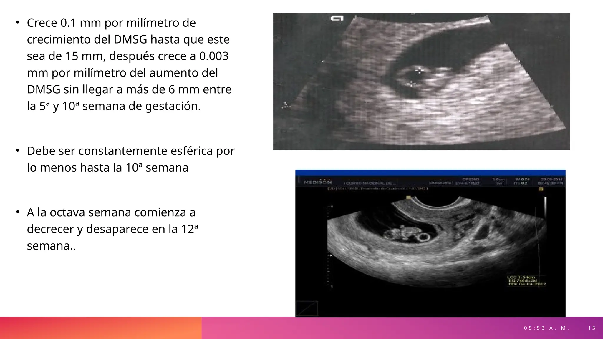 0 5 : 5 3 A . M . 1 5
• Crece 0.1 mm por milímetro de
crecimiento del DMSG hasta que este
sea de 15 mm, después crece a 0.003
mm por milímetro del aumento del
DMSG sin llegar a más de 6 mm entre
la 5ª y 10ª semana de gestación.
• Debe ser constantemente esférica por
lo menos hasta la 10ª semana
• A la octava semana comienza a
decrecer y desaparece en la 12ª
semana..
 