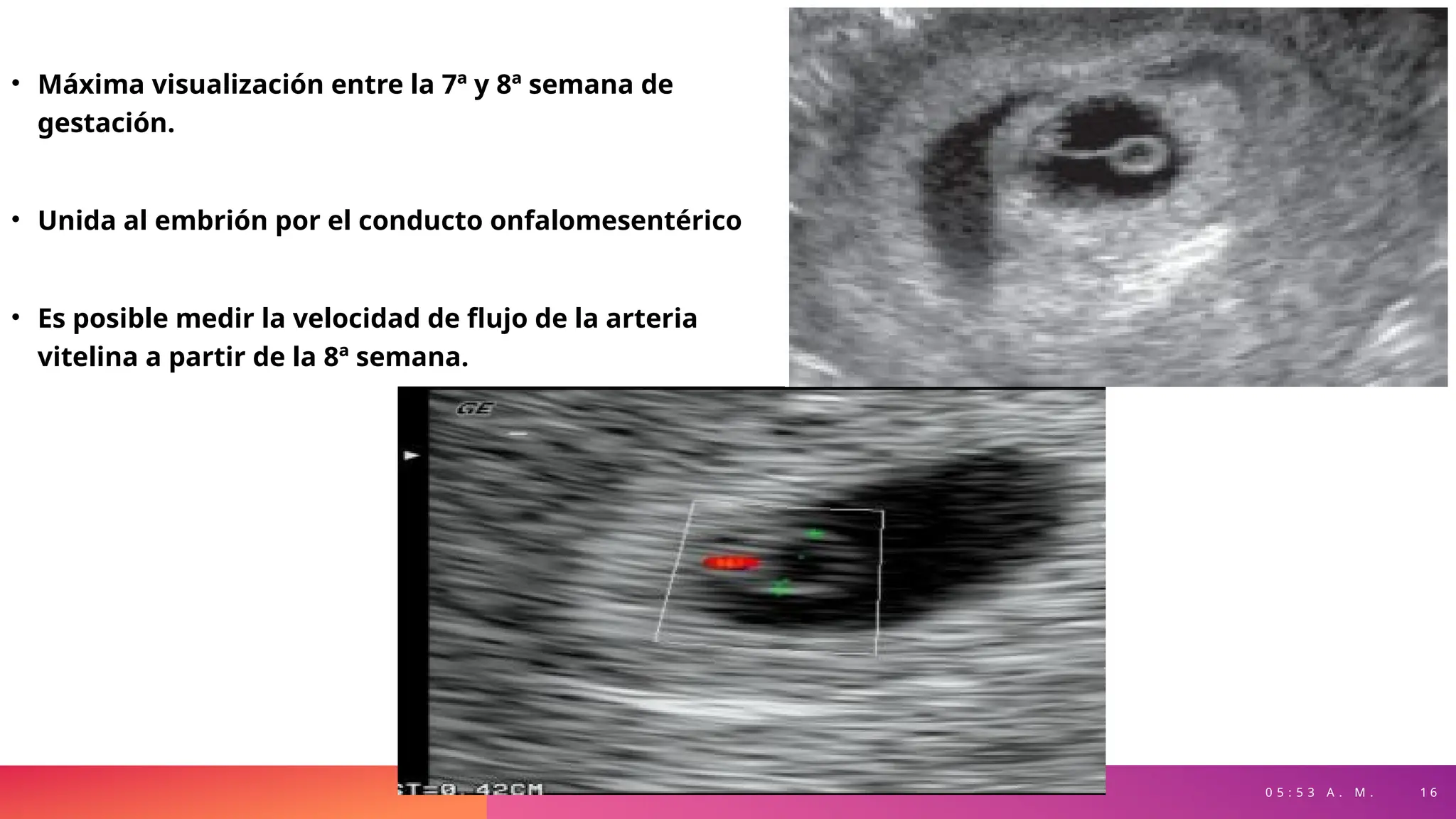 0 5 : 5 3 A . M . 1 6
• Máxima visualización entre la 7ª y 8ª semana de
gestación.
• Unida al embrión por el conducto onfalomesentérico
• Es posible medir la velocidad de flujo de la arteria
vitelina a partir de la 8ª semana.
 