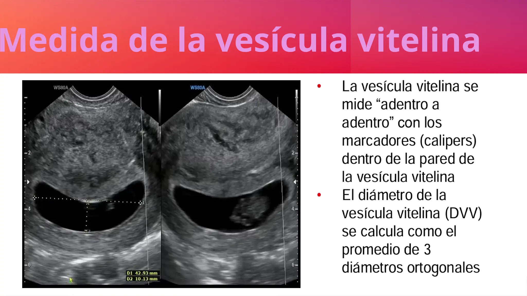 Medida de la vesícula vitelina
 