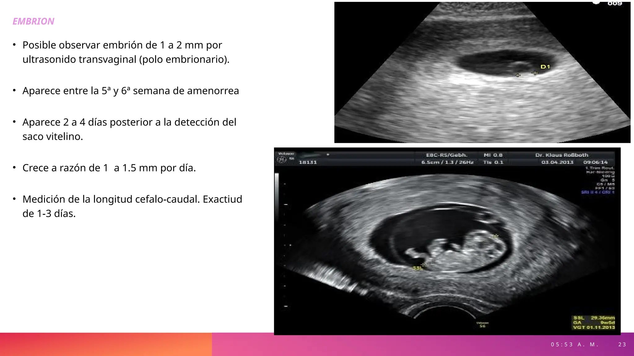 0 5 : 5 3 A . M . 2 3
EMBRION
• Posible observar embrión de 1 a 2 mm por
ultrasonido transvaginal (polo embrionario).
• Aparece entre la 5ª y 6ª semana de amenorrea
• Aparece 2 a 4 días posterior a la detección del
saco vitelino.
• Crece a razón de 1 a 1.5 mm por día.
• Medición de la longitud cefalo-caudal. Exactiud
de 1-3 días.
 